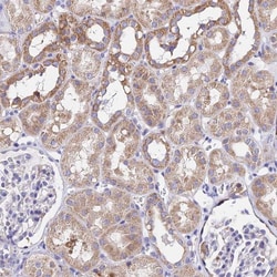 MRPL3 Antibody, Novus Biologicals 0.1mL; Unlabeled:Antibodies, Polyclonal